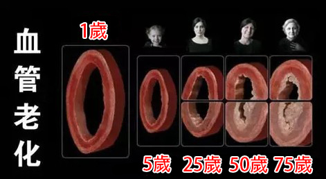 高血壓 高血壓